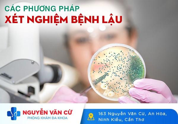 Các Phương Pháp Xét Nghiệm Bệnh Lậu Hiện Nay