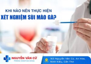 Khi Nào Nên Thực Hiện Xét Nghiệm Sùi Mào Gà?