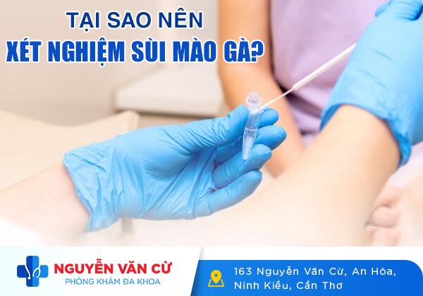 Tại Sao Nên Xét Nghiệm Sùi Mào Gà? Xét Nghiệm Sùi Mào Gà Ở Đâu Cần Thơ Uy Tín?